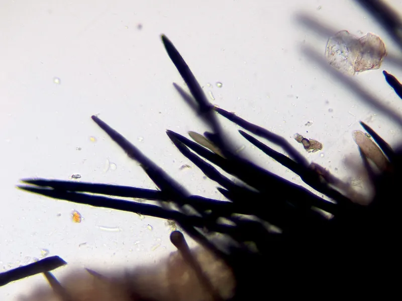 Chaetosphaerella phaeostroma 11 - Setulas x 400-001